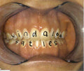 Fat Les : Vindaloo (CD, Single, Nim)